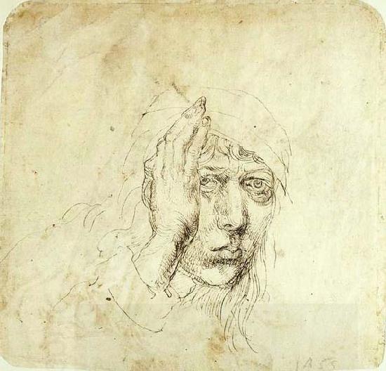 Albrecht Durer Self-Portrait with a Bandage